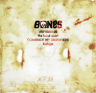 bones